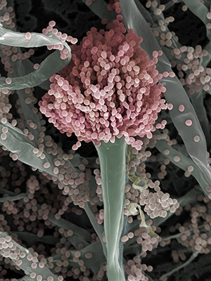 Aspergillus fumigatus